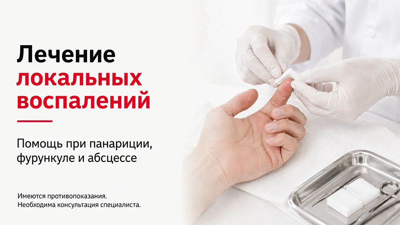 Лечение локальных воспалений