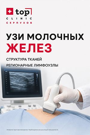 УЗИ молочных желез
