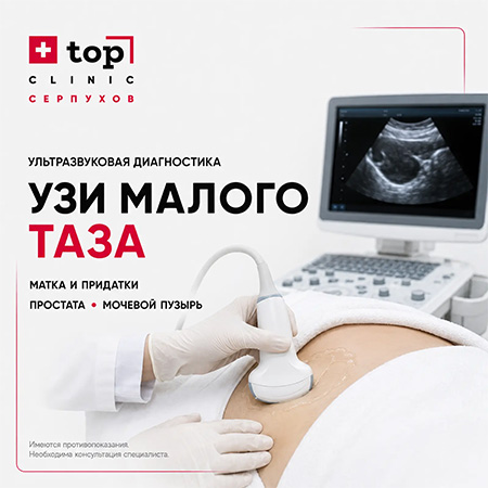 УЗИ малого таза